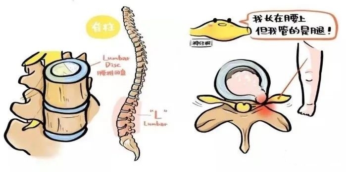 还在被脊柱病折磨？别愁，脊柱内镜技术，“小孔”治病不开刀！